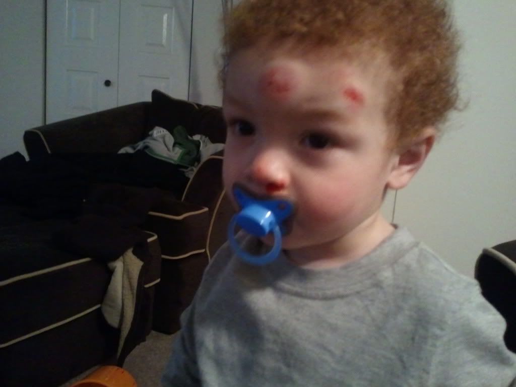 My baby fell on his face today!!! ( BabyCenter